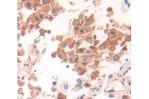 Figure. (CUTC antibody  (AA 1-273))