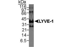 Western blot analysis of LYVE1 in recombinant human protein using LYVE1 polyclonal antibody . (LYVE1 antibody  (AA 250-322))