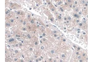 Immunohistochemistry (IHC) image for anti-CD34 (CD34) (AA 32-290) antibody (ABIN7426406)