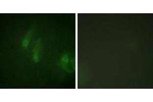 P-peptide - +Immunofluorescence analysis of HeLa cells, using FANCA (Phospho-Ser1149) antibody.