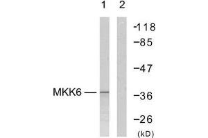 Western blot analysis of extract from MDA-MB-435 cells, using MKK6 (Ab-207) antibody (E021153). (MAP2K6 antibody)