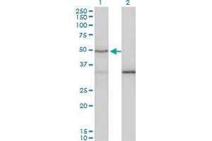 Western Blot analysis of SMAD3 expression in transfected 293T cell line by SMAD3 monoclonal antibody (M02), clone 7F3. (SMAD3 antibody  (AA 120-221))