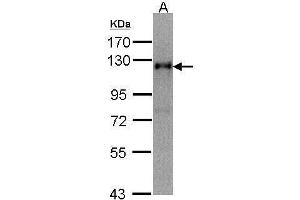 TIMELESS antibody  (N-Term)