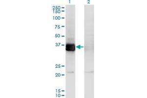 Western Blot analysis of PHF11 expression in transfected 293T cell line by PHF11 monoclonal antibody (M01), clone 3B8. (PHF11 antibody  (AA 1-292))