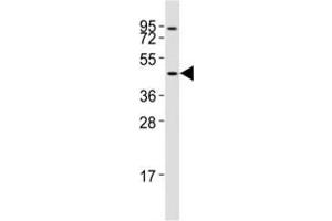 Western blot testing of CCR1 antibody at 1:2000 dilution + Jurkat lysate; Predicted band size : 40-45 kDa. (CCR1 antibody  (AA 343-355))
