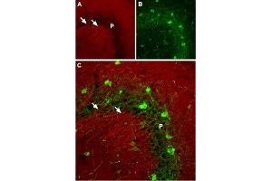 Expression of NaV1. (SCN2A antibody  (Intracellular))