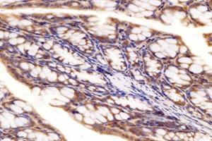 Immunohistochemistry analysis of paraffin-embedded mouse colon using,RRAGB (ABIN7075379) at dilution of 1: 4000 (RRAGB antibody)