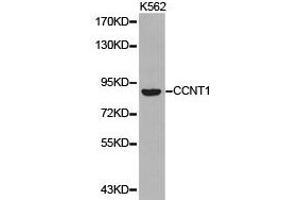 Western Blotting (WB) image for anti-Cyclin T1 (CCNT1) antibody (ABIN1871567) (Cyclin T1 antibody)