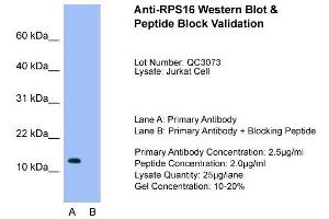 Western Blotting (WB) image for anti-Ribosomal Protein S16 (RPS16) (N-Term) antibody (ABIN2777990)