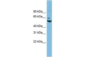 WB Suggested Anti-ZNF563 Antibody Titration: 0. (ZNF563 antibody  (N-Term))