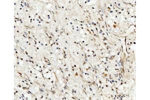 IHC analysis of RRP4/EXOSC2 using anti-RRP4/EXOSC2 antibody (ABIN7602188). (EXOSC2 antibody  (AA 62-293))