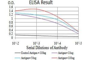 Black line: Control Antigen (100 ng), Purple line: Antigen(10 ng), Blue line: Antigen (50 ng), Red line: Antigen (100 ng),
