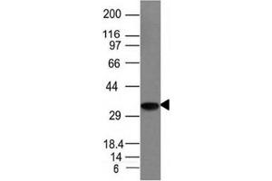 Western blot analysis of Raji cell lysate using CLIP antibody (CLIP/1133) (CLIP antibody)