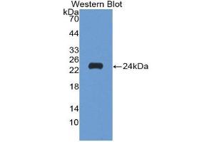 Western Blotting (WB) image for anti-Matrix Metallopeptidase 9 (Gelatinase B, 92kDa Gelatinase, 92kDa Type IV Collagenase) (MMP9) (AA 213-399) antibody (ABIN3201434) (MMP 9 antibody  (AA 213-399))