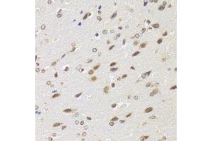 Immunohistochemistry of paraffin-embedded rat brain using BAZ1B antibody. (BAZ1B antibody)