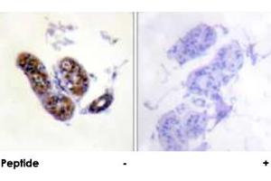 Immunohistochemical analysis of paraffin-embedded human skin tissue using MITF polyclonal antibody . (MITF antibody  (Ser73, Ser180))