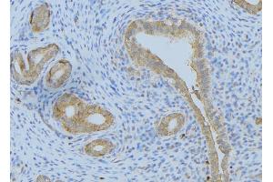ABIN6275102 at 1/100 staining Human uterus tissue by IHC-P. (FBLN4 antibody  (Internal Region))