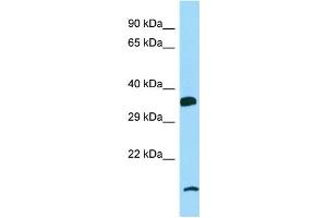 Host: Rabbit Target Name: P2RY6 Sample Type: MCF7 Whole Cell lysates Antibody Dilution: 1. (P2RY6 antibody  (N-Term))