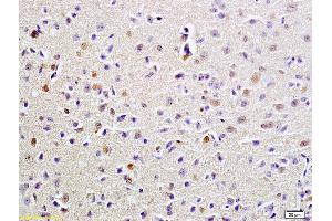 Formalin-fixed and paraffin embedded rat brain labeled with Anti-FUS Polyclonal Antibody, Unconjugated (ABIN682438) at 1:200 followed by conjugation to the secondary antibody and DAB staining (FUS antibody  (AA 421-526))