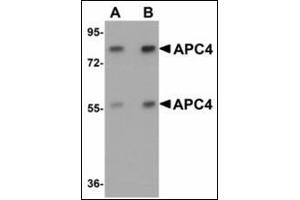 Western blot analysis of APC4 in mouse liver tissue lysate with APC4 antibody at (A) 1 and (B) 2 µg/ml. (ANAPC4 antibody  (N-Term))