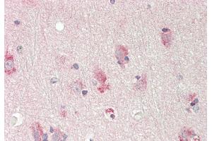 Rabbit Anti-ST6GALNAC1 antibody  Formalin Fixed Paraffin Embedded Tissue: Human Brain, Cortex Primary antibody Concentration: 1:100 Secondary Antibody: Donkey anti-Rabbit-Cy3 Secondary Antibody Concentration: 1:200 Magnification: 20x Exposure Time: 0. (ST6GALNAC1 antibody  (Middle Region))