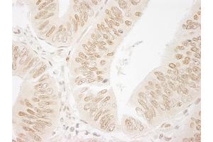 Immunohistochemistry (IHC) image for anti-Bromodomain PHD Finger Transcription Factor (BPTF) (AA 1350-1400) antibody (ABIN7448561) (BPTF antibody  (AA 1350-1400))