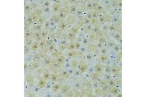 Immunohistochemistry of paraffin-embedded rat liver using SOX14 antibody (ABIN6292418) at dilution of 1:100 (40x lens). (SOX14 antibody)