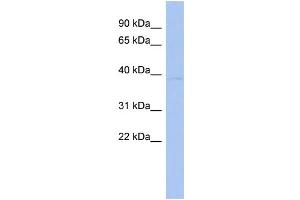 WB Suggested Anti-PDGFD Antibody Titration: 0.