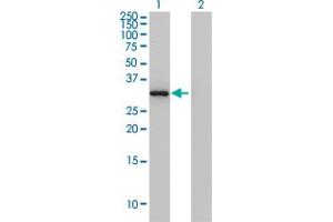 Western Blot analysis of ANXA3 expression in transfected 293T cell line by ANXA3 monoclonal antibody (M12), clone 4F1. (Annexin A3 antibody  (AA 1-323))