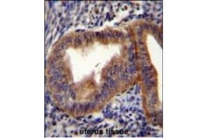 CCNB1 Antibody (Center) (ABIN655048 and ABIN2844676) immunohistochemistry analysis in formalin fixed and paraffin embedded human uterus tissue followed by peroxidase conjugation of the secondary antibody and DAB staining. (Cyclin B1 antibody  (AA 241-268))