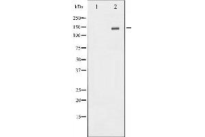 Western blot analysis of Met expression in HepG2 whole cell lysates,The lane on the left is treated with the antigen-specific peptide. (c-MET antibody  (C-Term))