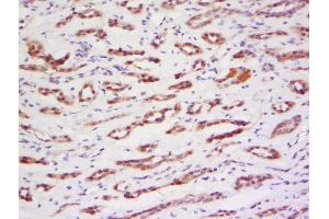 Formalin-fixed and paraffin embedded human kidney labeled with Anti-PRAM1 Polyclonal Antibody, Unconjugated  at 1:200 followed by conjugation to the secondary antibody and DAB staining. (PRAM1 antibody  (AA 551-650))