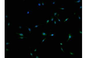 Immunofluorescence staining of U251 cells with ABIN7174848 at 1:100, counter-stained with DAPI. (C3orf38 antibody  (AA 80-329))