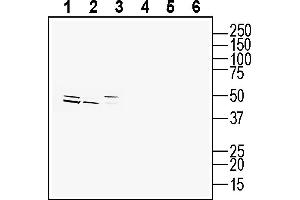 anti-Chemokine (C-C Motif) Receptor 2 (CCR2) (AA 19-32), (Extracellular) antibody