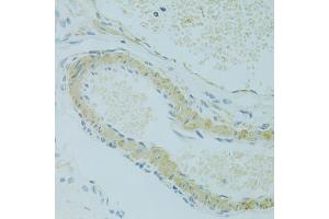 Immunohistochemistry of paraffin-embedded rat ovary using IFT57 antibody (ABIN6292987) at dilution of 1:100 (40x lens). (IFT57 antibody)