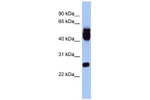 ERAS antibody used at 1 ug/ml to detect target protein. (ERAS antibody  (Middle Region))