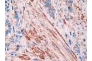 Immunohistochemistry (IHC) image for anti-Filamin A, alpha (FLNA) (AA 2-274) antibody (ABIN7440788)
