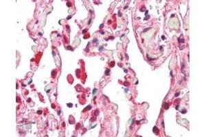 ABIN185097 (5µg/ml) staining of paraffin embedded Human Lung. (Centaurin beta 2 antibody  (C-Term))