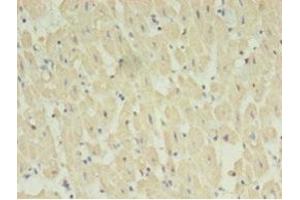 Immunohistochemistry of paraffin-embedded human heart tissue using ABIN7170733 at dilution of 1:100 (STRADB antibody  (AA 212-418))