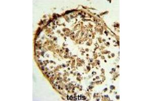 Immunohistochemistry (IHC) image for anti-Cathepsin S (CTSS) antibody (ABIN3003177) (Cathepsin S antibody)