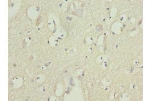 Immunohistochemistry of paraffin-embedded human brain tissue using ABIN7152580 at dilution of 1:100