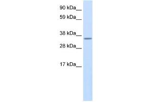WB Suggested Anti-Use1 Antibody Titration:  0. (UBE2Z antibody  (N-Term))