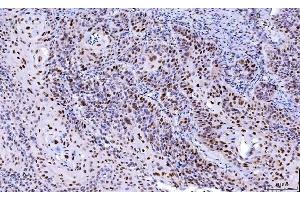 IHC analysis of Cdk2 using anti-Cdk2 antibody (ABIN7602522). (CDK2 antibody  (AA 81-298))