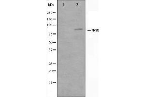 Western blot analysis on HepG2 cell lysate using HGS Antibody. (HGS antibody  (Internal Region))