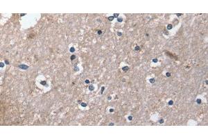 Immunohistochemistry of paraffin-embedded Human brain using DUT Polyclonal Antibody at dilution of 1:30 (Deoxyuridine Triphosphatase (DUT) antibody)