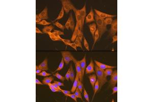 Immunofluorescence analysis of NIH-3T3 cells using  Rabbit mAb (ABIN7265669) at dilution of 1:100 (40x lens). (ASS1 antibody)