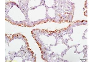 Formalin-fixed and paraffin embedded rat lung tissue labeled with Anti-CD2AP Polyclonal Antibody  , Unconjugated at 1:200, followed by conjugation to the secondary antibody and DAB staining (CD2AP antibody  (AA 561-641))