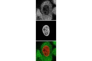 ABIN185157 staining (top panel and green) of 4% formaldahyde-fixed HeLa with endogenously expressed HistonH2B-GFP fusion as DNA marker (mid panel and red).