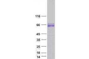 Validation with Western Blot