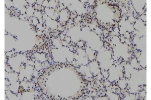 ABIN6278303 at 1/100 staining Mouse lung tissue by IHC-P. (Plakophilin 3 antibody  (C-Term))